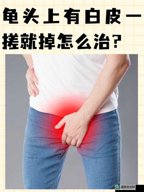 小弟里面有白色的东西怎么清理：专业且有效的处理方法指南